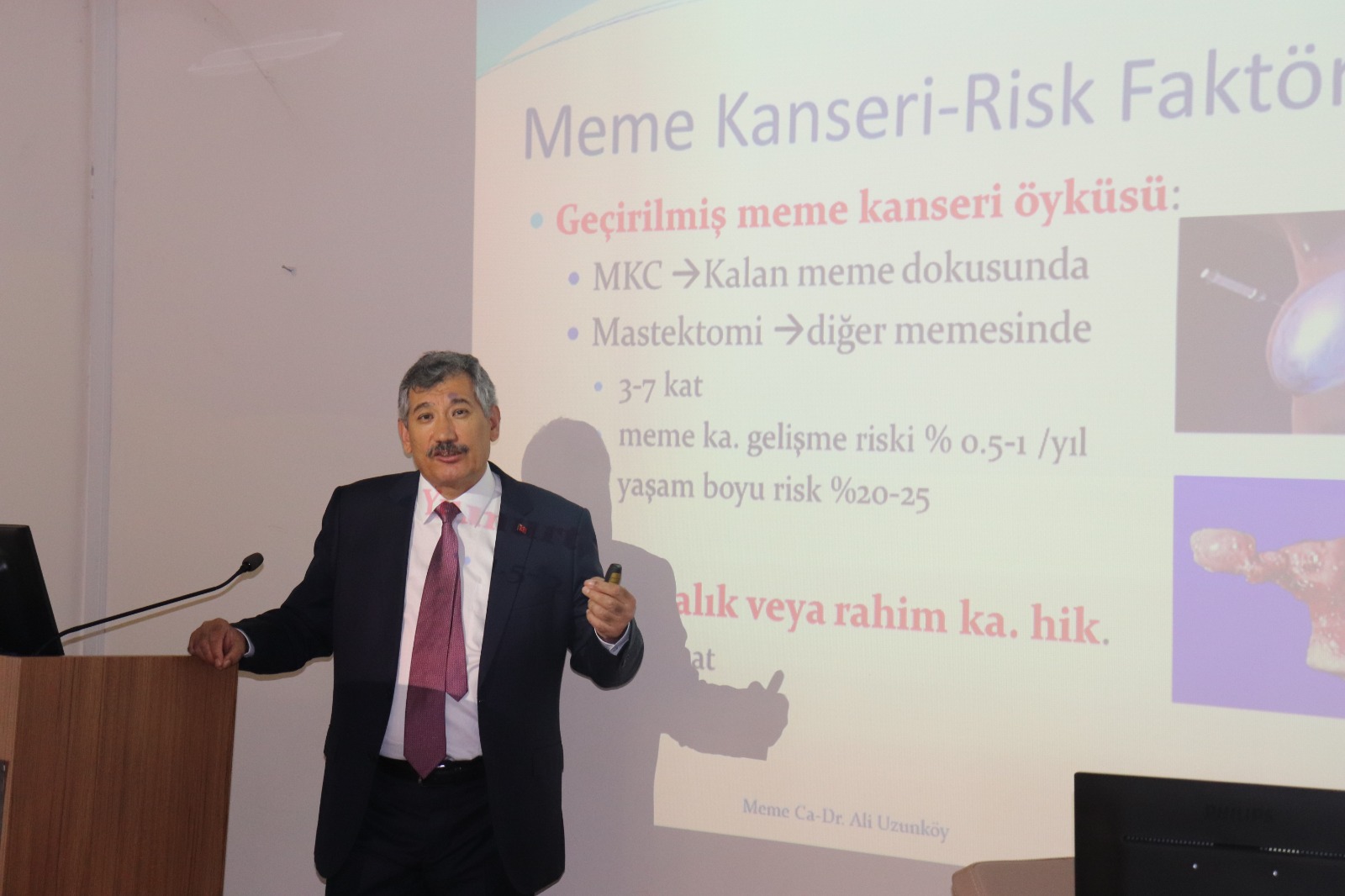 Meme Kanseri Nasıl Önlenebilir?